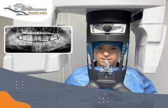 ¡Radiografía Panorámica Dental Digital!