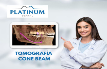 ¡Tomografía dental Cone Beam campo mediano y pequeño! con Platinum Dental